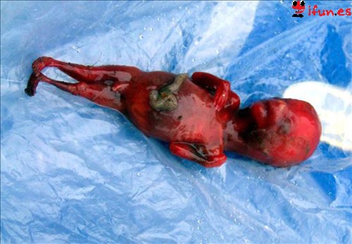 feto-humano-gallina